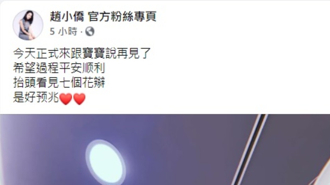 趙小僑透漏自己進行引產手術。(圖/翻攝自趙小僑臉書)