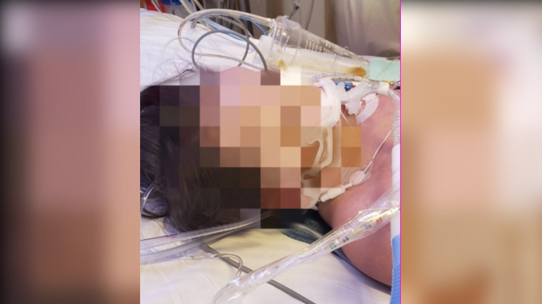 男童以醫療器材維持呼吸,最後仍不治身亡。(圖/翻攝自「The Babyphoria Project」FB)