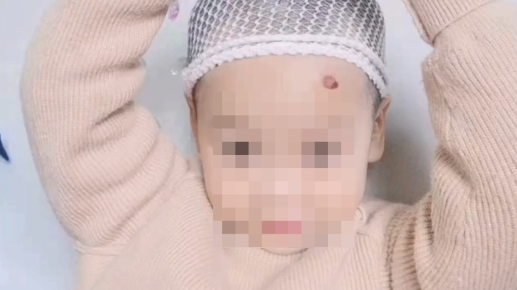 女童罹患腦瘤仍樂觀面對。(圖/翻攝自微博)