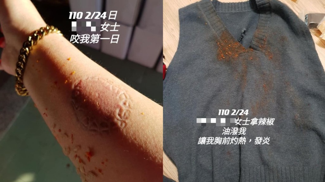 驚世婆婆咬人潑辣油　前空姐控「嫁小7歲尪被嫌」齒痕曝