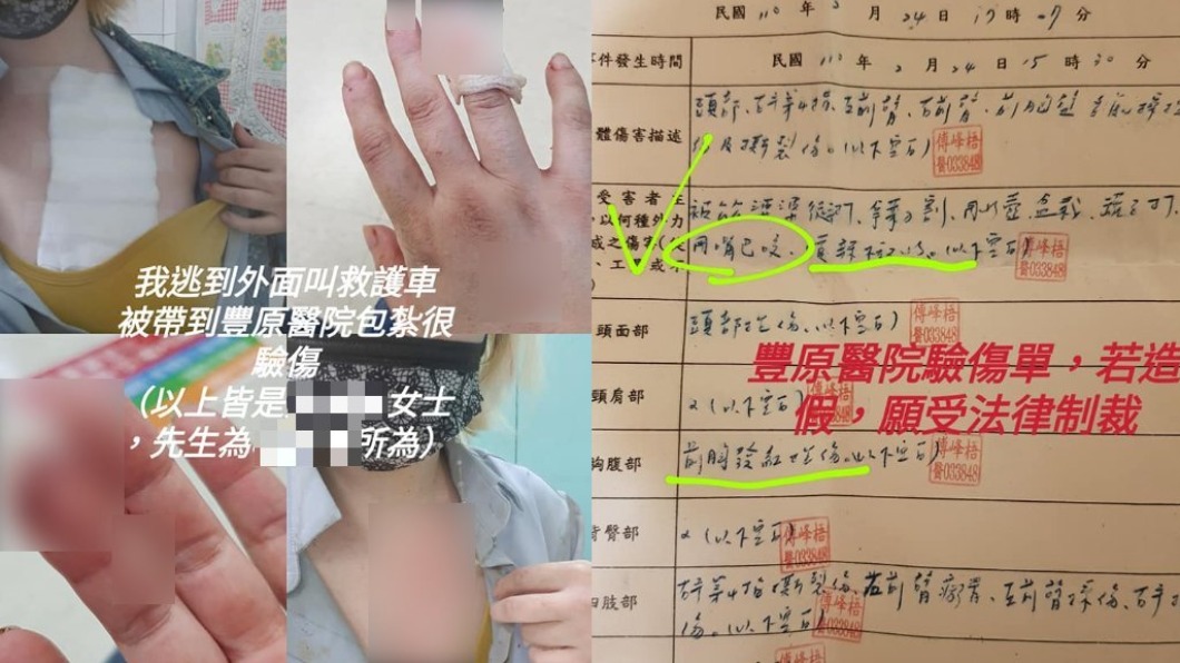 人妻指控遭婆婆傷害,到醫院治療驗傷。(圖/翻攝自爆料公社二社)