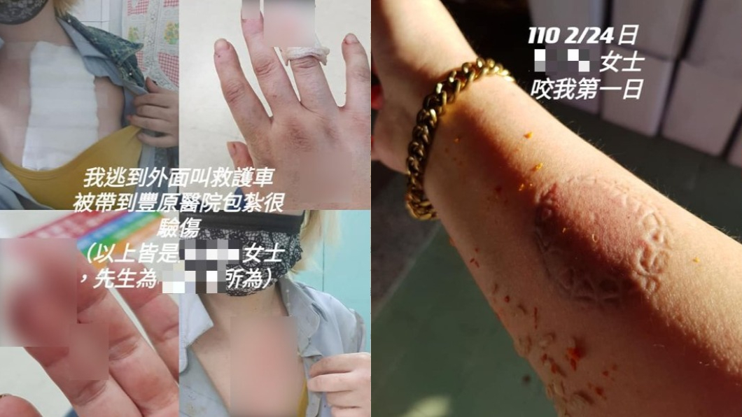 前空姐遭菜刀削肉潑辣油 公婆轟自導自演:被掌摑、勒脖