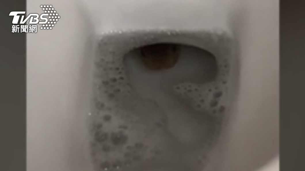 男子在馬桶中發現咖啡色異物。(圖/翻攝自每日郵報)