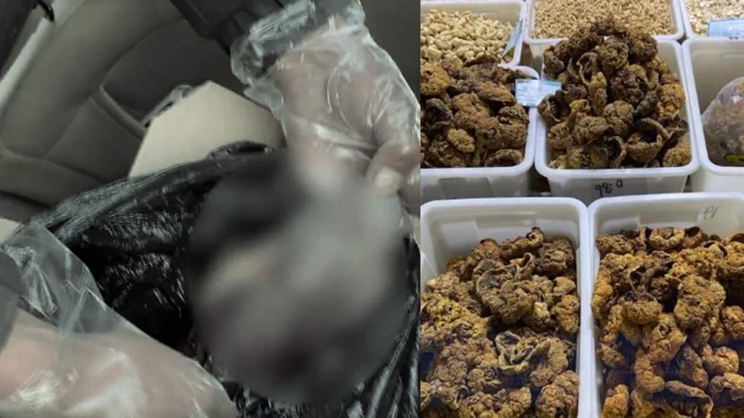 殯儀館買胎盤出售! 陸黑心商:不能保證無愛滋