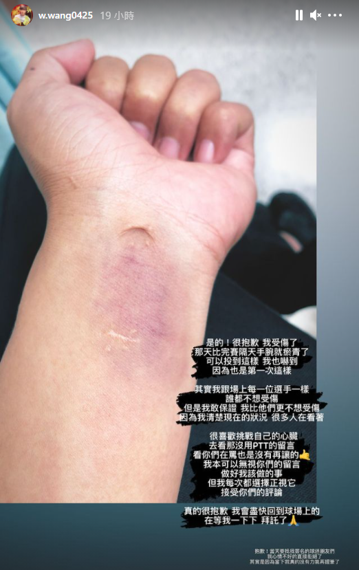 王維中曬出照片,表示自己受傷了。(圖/翻攝自w.wang0425 IG)