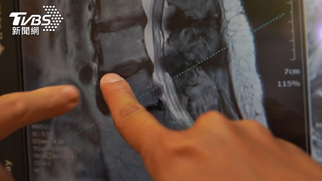 咖啡加速骨質流失? 醫曝真相:多曬太陽補回來