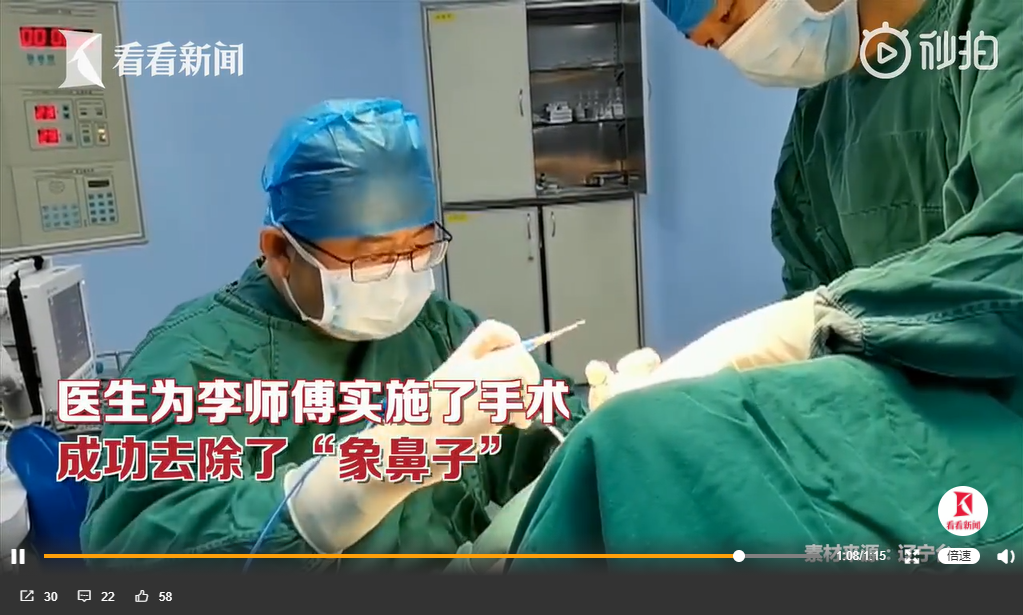 李男手術後成功擺脫惱人的象鼻子。(圖/翻攝自看看新聞微博)
