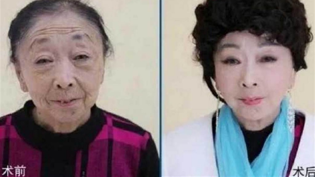女方為了讓自己的外貌看起來和男方更匹配,花了大錢整形。(圖/翻攝自微博)