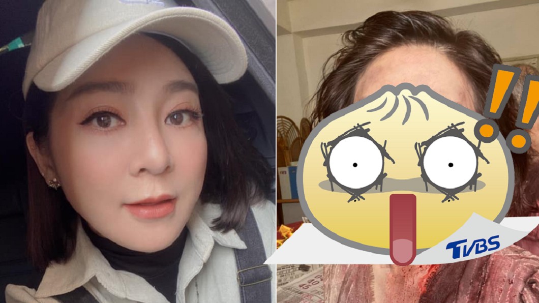 白眼珠渾身血! 王彩樺活屍照嚇壞眾人:先不要