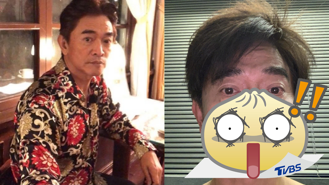 吳宗憲「臉頰腫成球」嚇壞哀號 粉絲驚:以為是翁立友