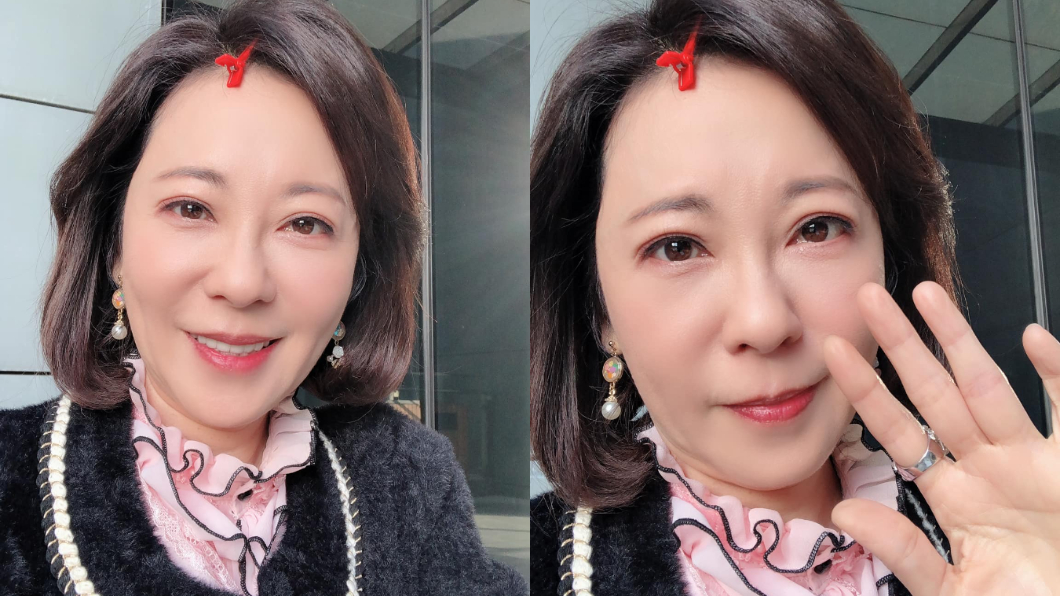 況明潔手指腫脹。(圖/翻攝自況明潔Facebook)