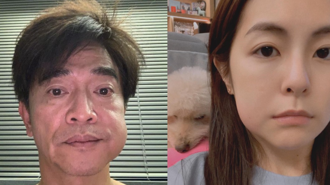 吳宗憲拔牙「臉腫一大包」 醫:做對2步驟快速消腫