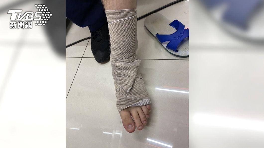 值勤員警的腳遭林女駕駛的車輛輾壓造成扭傷。(圖/TVBS)
