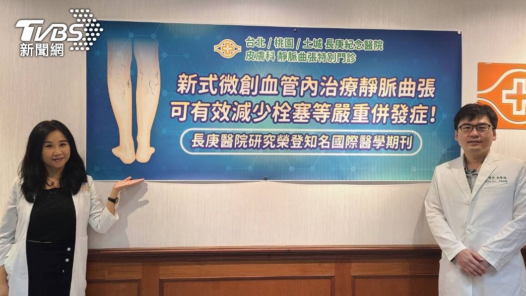 小心!靜脈曲張嚴重恐害命 研究:肺栓塞風險高近倍