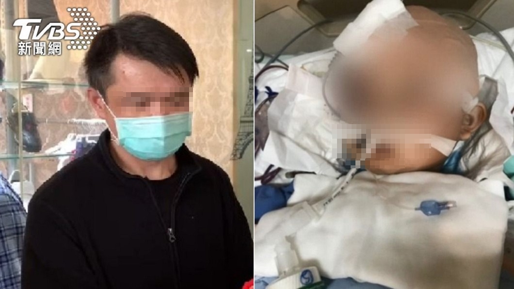 柔道童恐成植物人!爸求償千萬遭爆「假慈父撈錢」已離婚
