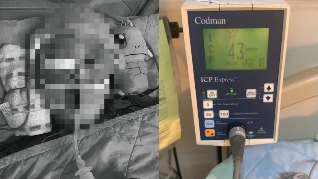 柔道童腦壓再降 父進病房見禮物淚崩:要完成男子漢約定
