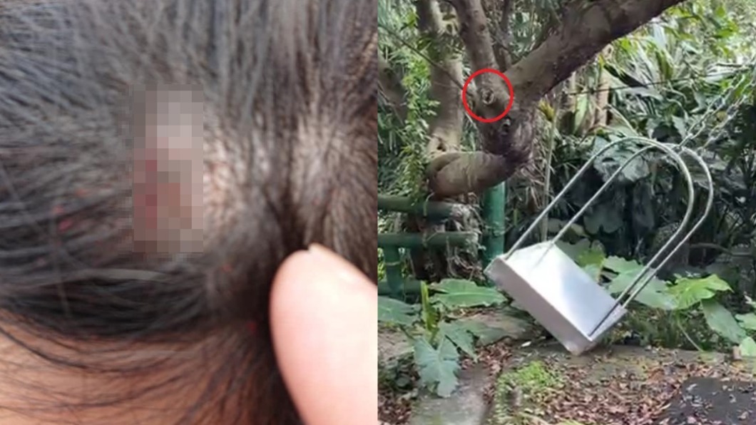 孩盪鞦韆慘「撞樹破頭」見血　母抱怨遭勸：家長應先注意