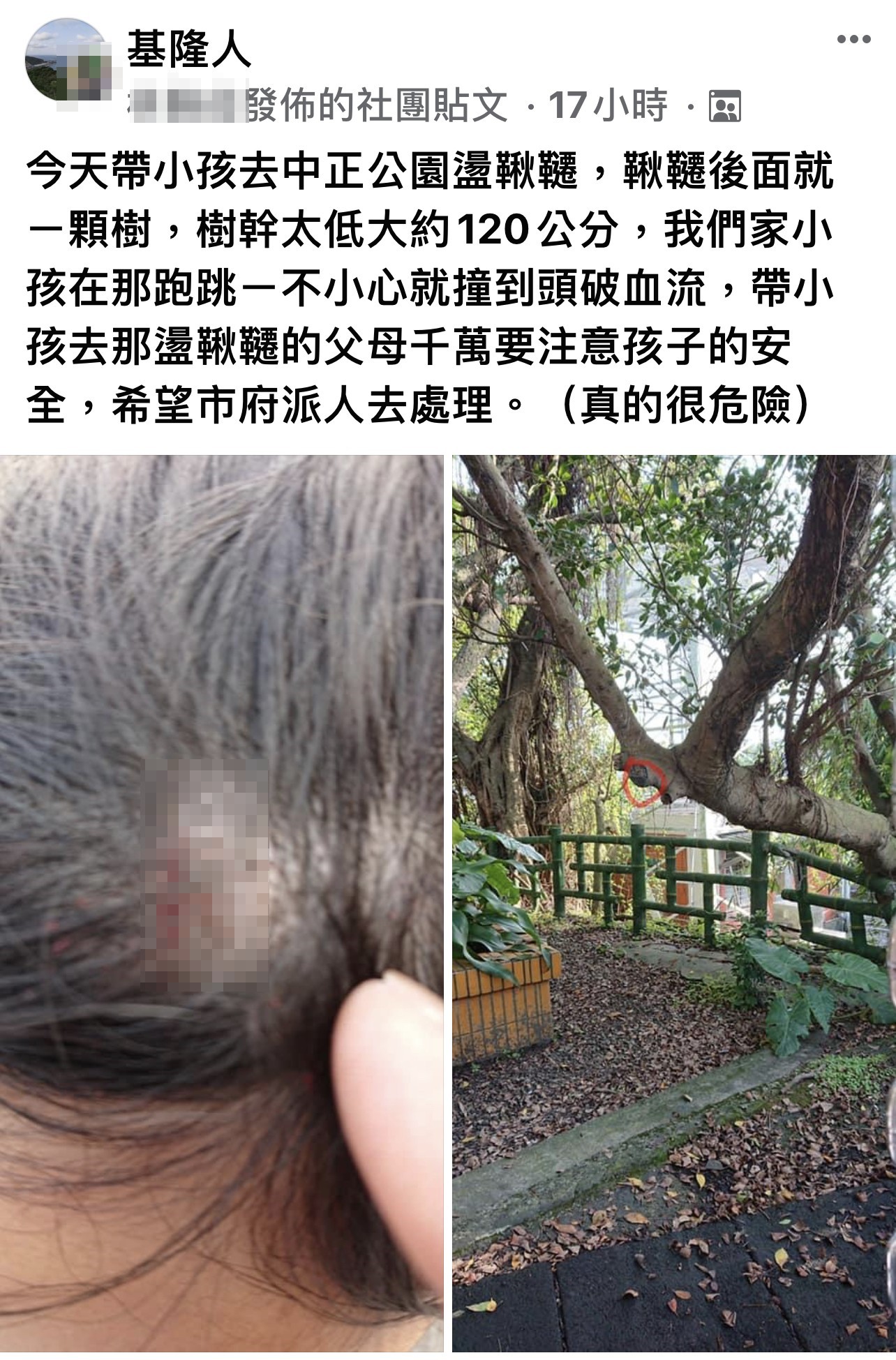 一名媽媽抱怨帶孩子到公園盪鞦韆,孩子卻不慎撞到後方樹幹受傷。(圖/翻攝自「基隆人」)