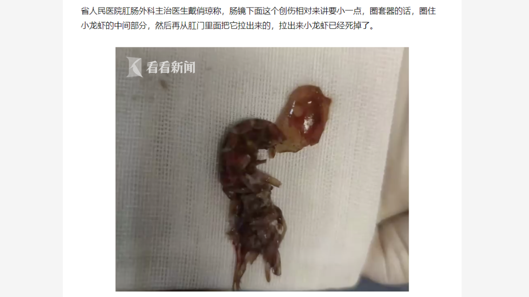 醫師手術取出小龍蝦。(圖/翻攝自看看新聞)