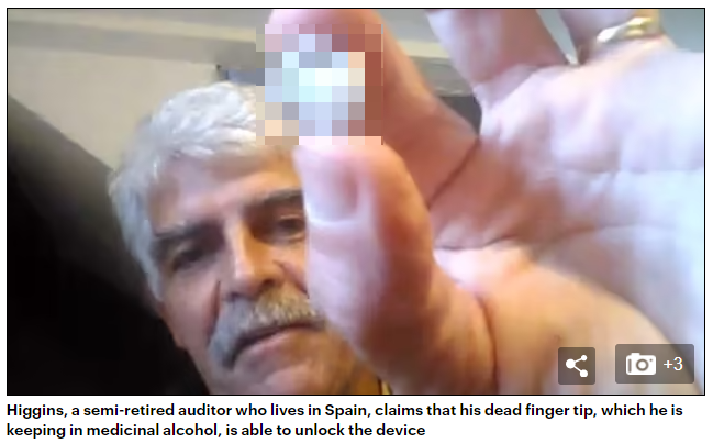 二拇弟因傷勢過重無法接回。（圖／翻攝自Daily Mail）