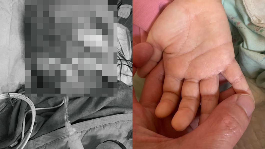 男童仍在昏迷中。(圖/翻攝自男童父親臉書)