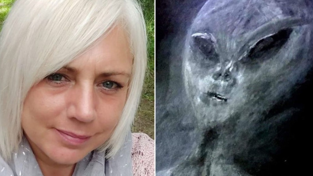 被外星人綁架52次 女秀瘀傷照揭「親密接觸」過程