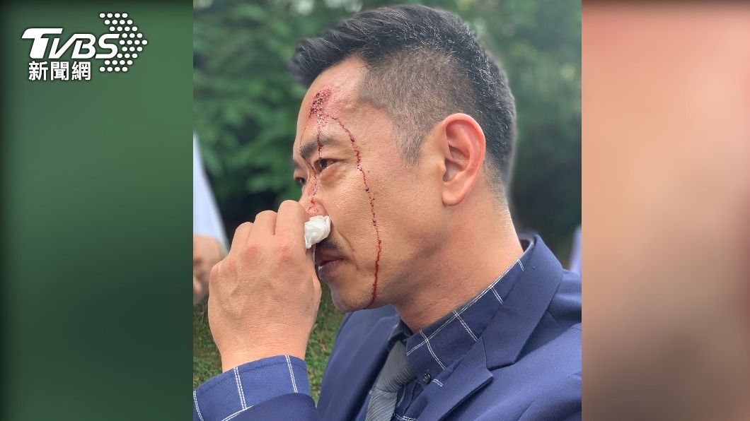 江俊翰劇中車禍嚴重,生死未卜。(圖/民視提供)