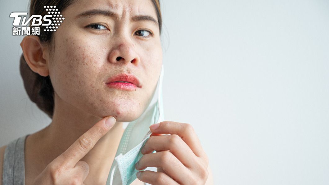 用手擠或粉剌針容易造成細菌感染。（示意圖／shutterstock達志影像）
