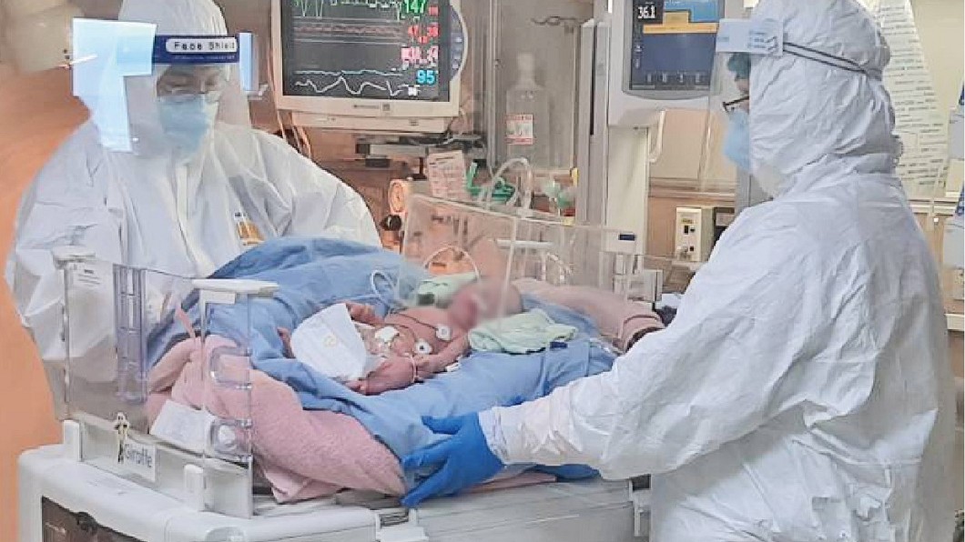 34週孕婦確診「血氧不足」恐傷胎兒!20醫護拚命接生