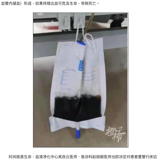 男子尿液變成醬油色。(圖/翻攝自都市快報)