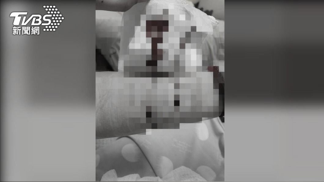 無視1人陪病規定! 護理師勸阻遭強拍識別證霸凌
