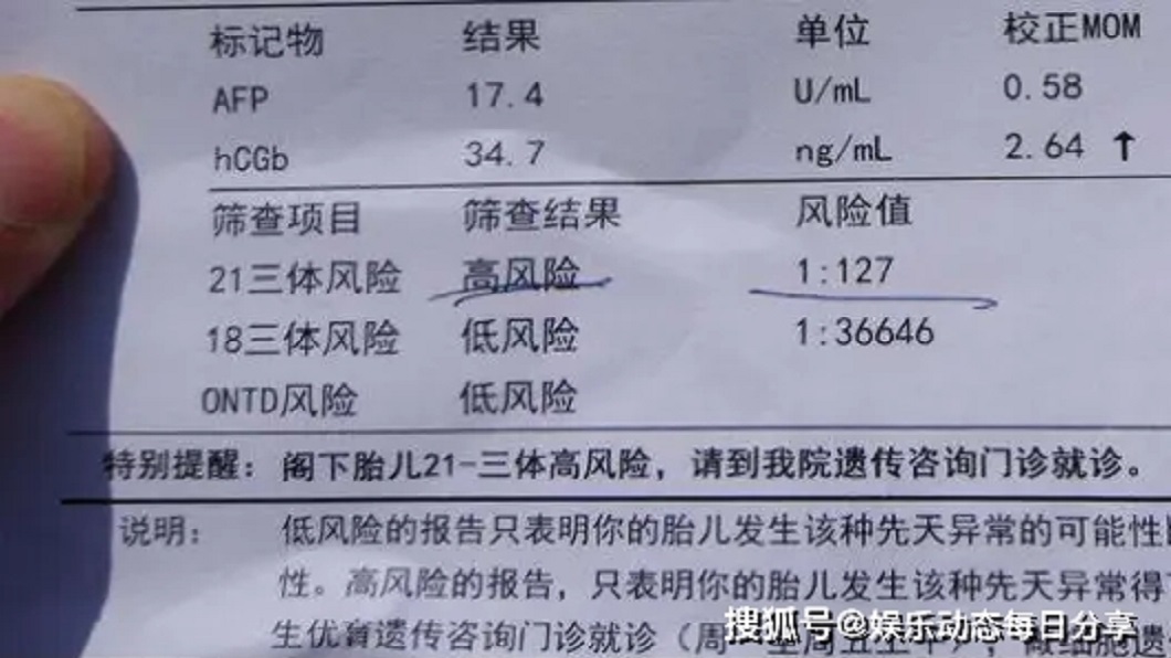 人妻懷孕16週去產檢時,醫師告知生下唐氏症寶寶的機率很高。(圖/翻攝自搜狐新聞)