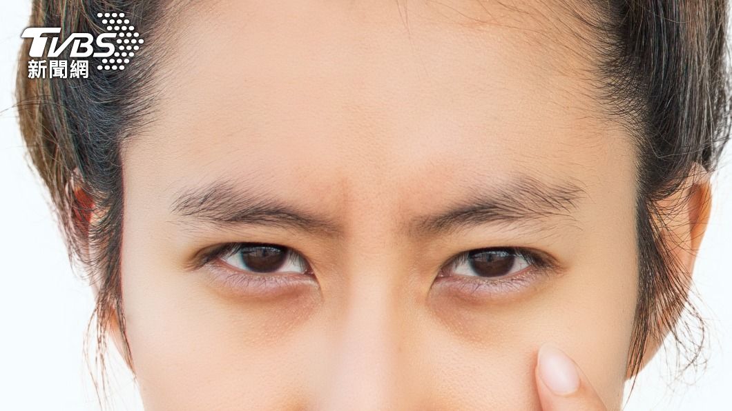黑眼圈會讓人看起來氣色差、沒精神還容易顯老。(示意圖/shutterstock達志影像)