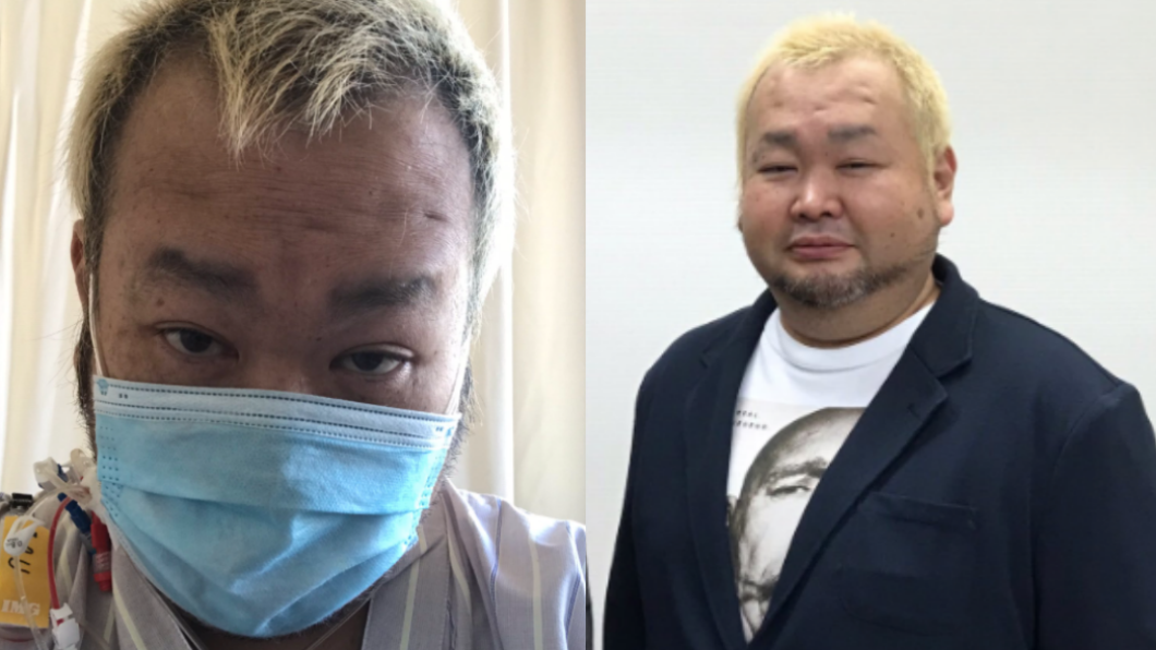 日男星確診新冠肺炎昏迷8天 「手腳肌肉萎縮」站立困難