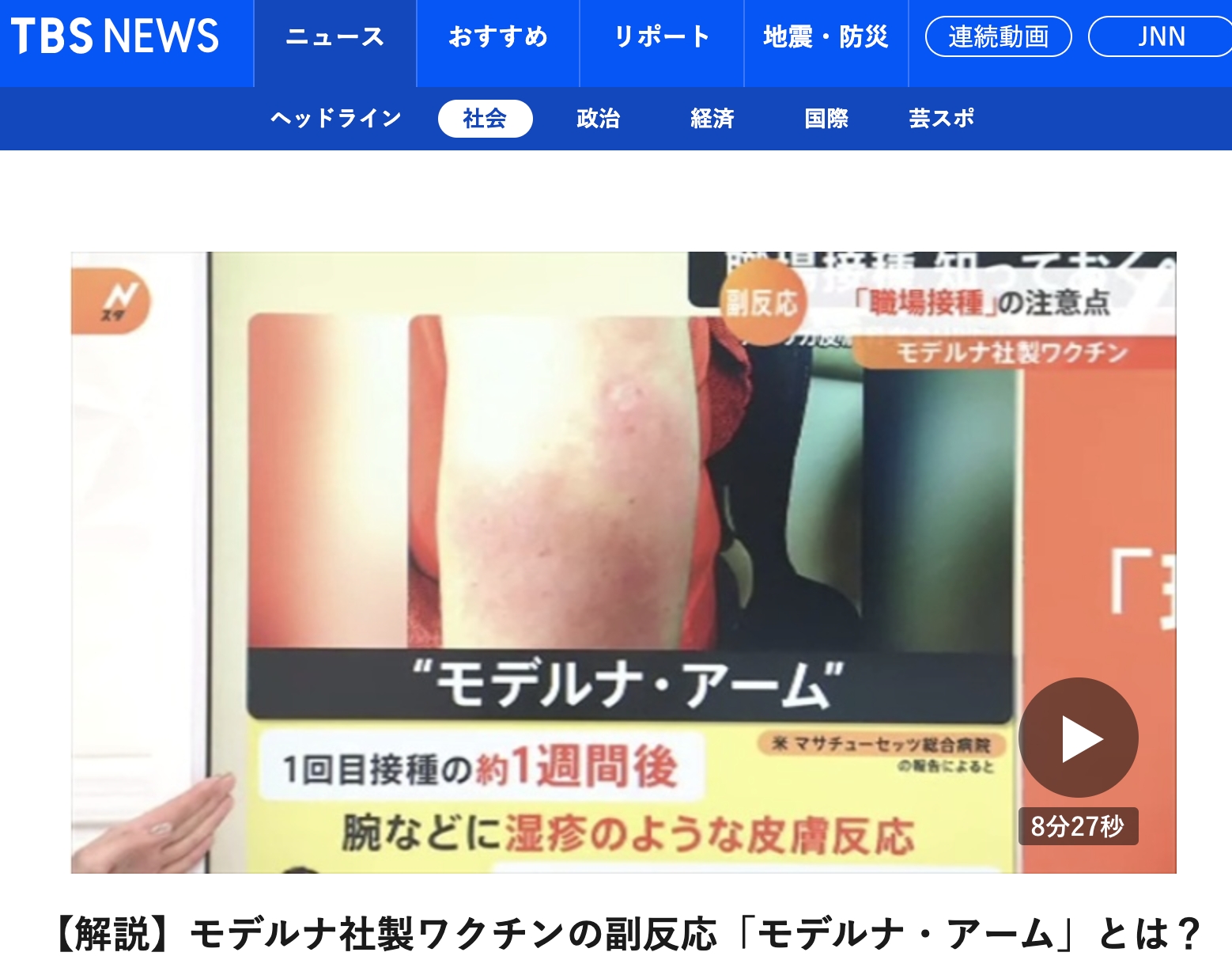 莫德納手臂。(圖/翻攝自《TBS NEWS》)