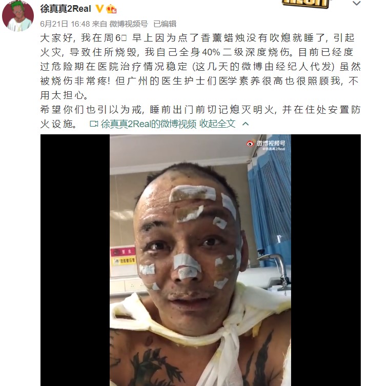 徐真真敘述事發經過。(圖/翻攝自徐真真微博)