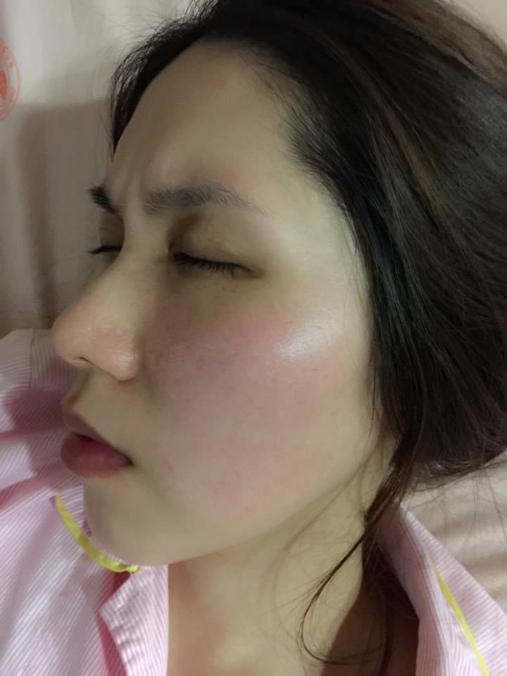 余苑綺癌細胞再擴散至大腿胯骨,預計8月動刀。(圖/翻攝自李亞萍臉書)