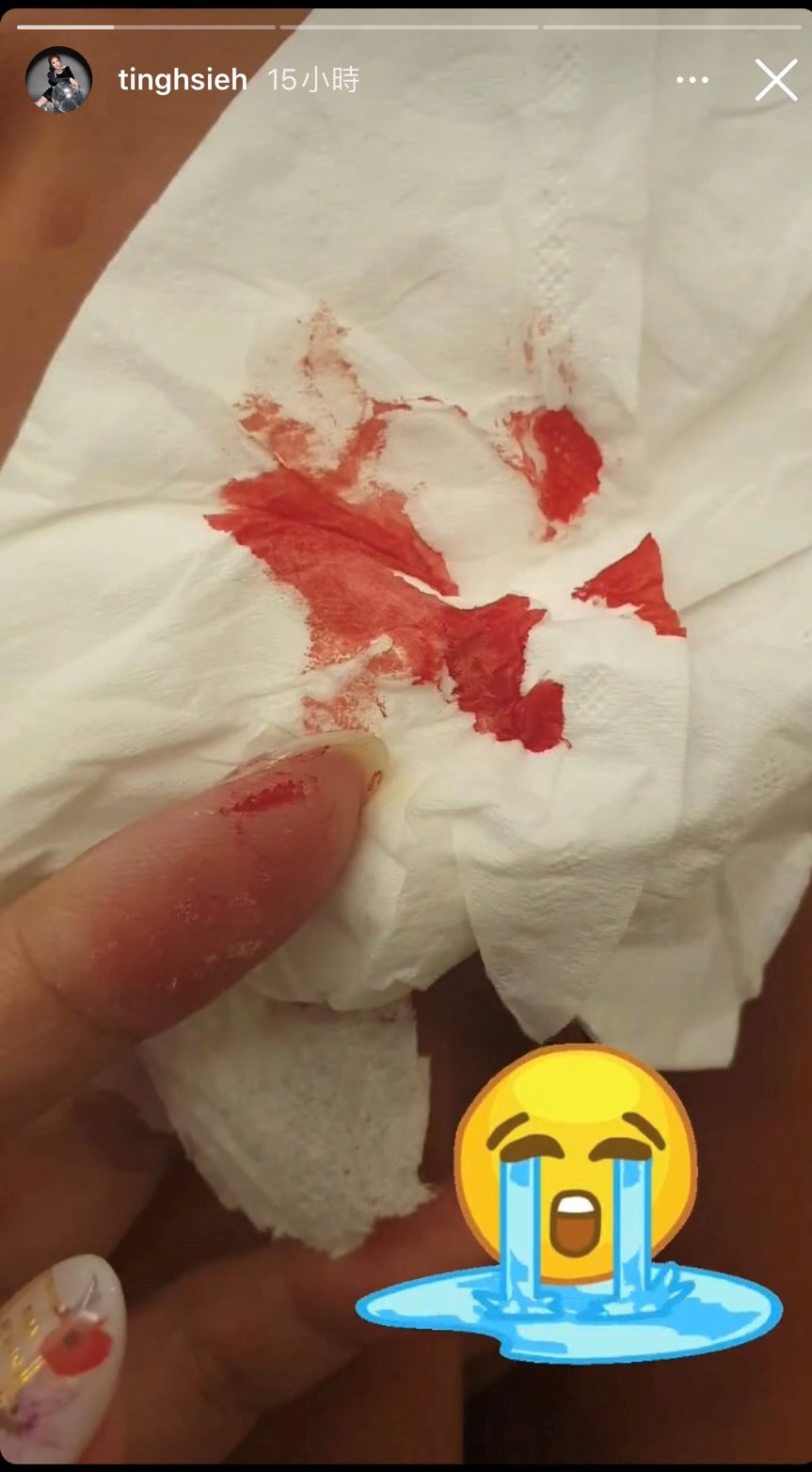 謝金晶突曬出衛生紙上全是血的照片。(圖/翻攝自謝金晶IG)