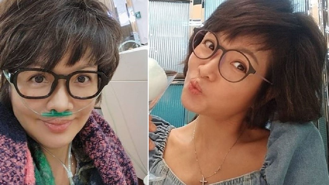 昔車禍顎骨碎毀容！女星三叉神經麻痺「左臉癱瘓」近況曝
