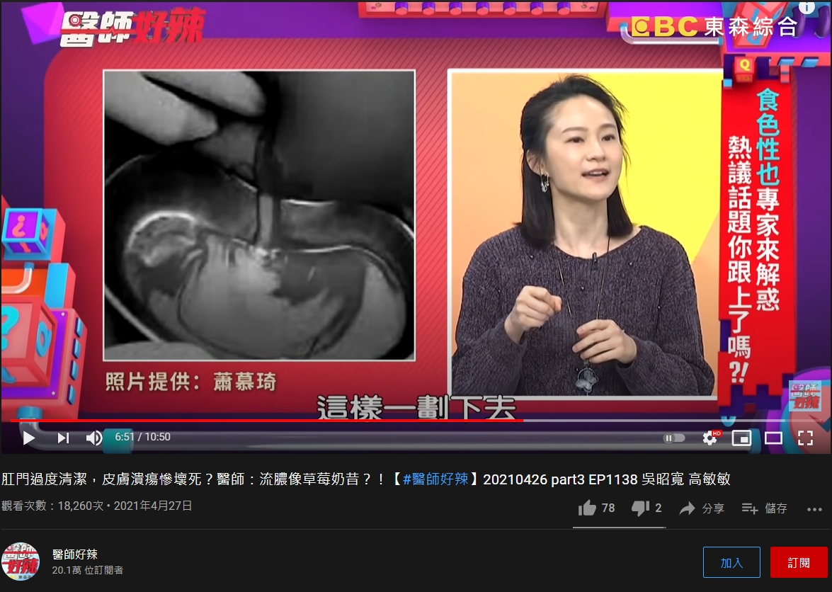 女子膿瘍劃開流出像「草莓奶昔」般的膿液。（圖／翻攝自《醫師好辣》）