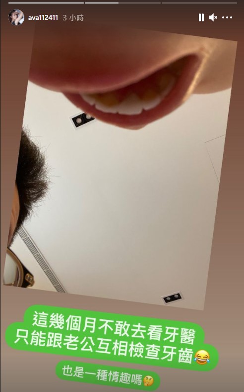 ㄚ頭曬出自己的口腔照。(圖/翻攝自ㄚ頭IG)