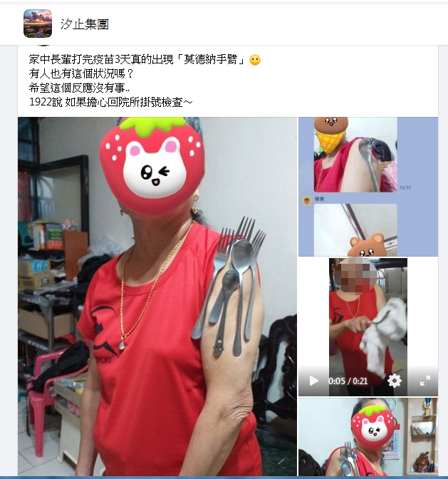 民眾打完疫苗後疑似出現「莫德納手臂」。(圖/翻攝自汐止社團臉書)