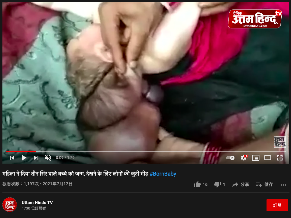 女嬰頭顱後方疑似有另外2顆頭。(圖/翻攝自 Uttam Hindu TV YouTube)