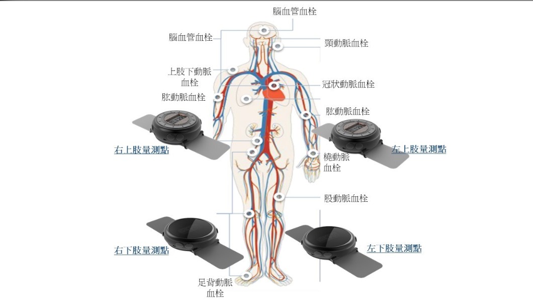 擔心「新冠血栓」找上?台大醫學院研發天天檢測血栓計