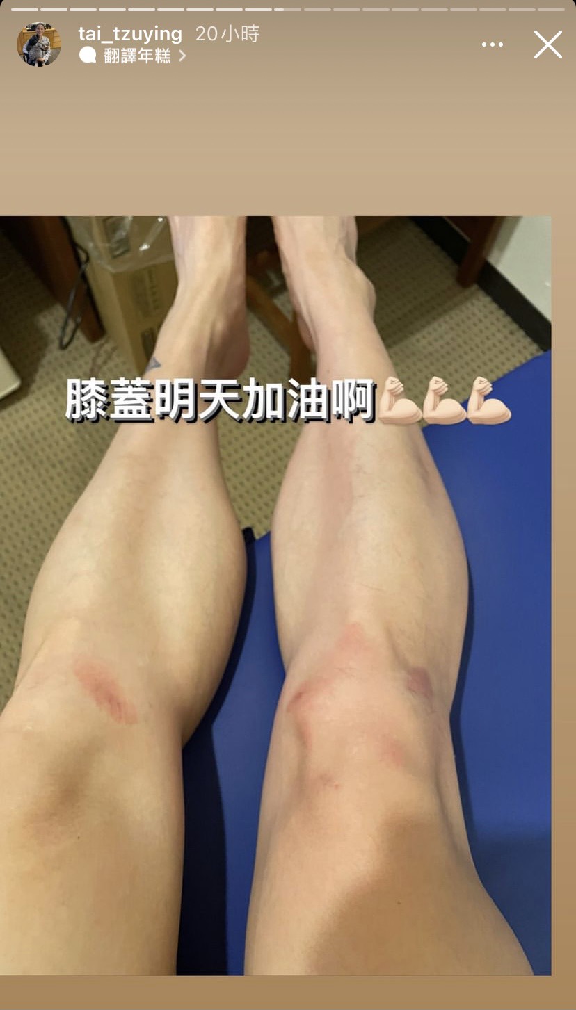 戴資穎雙腿擦傷讓人心疼。（圖／翻攝自戴資穎IG）