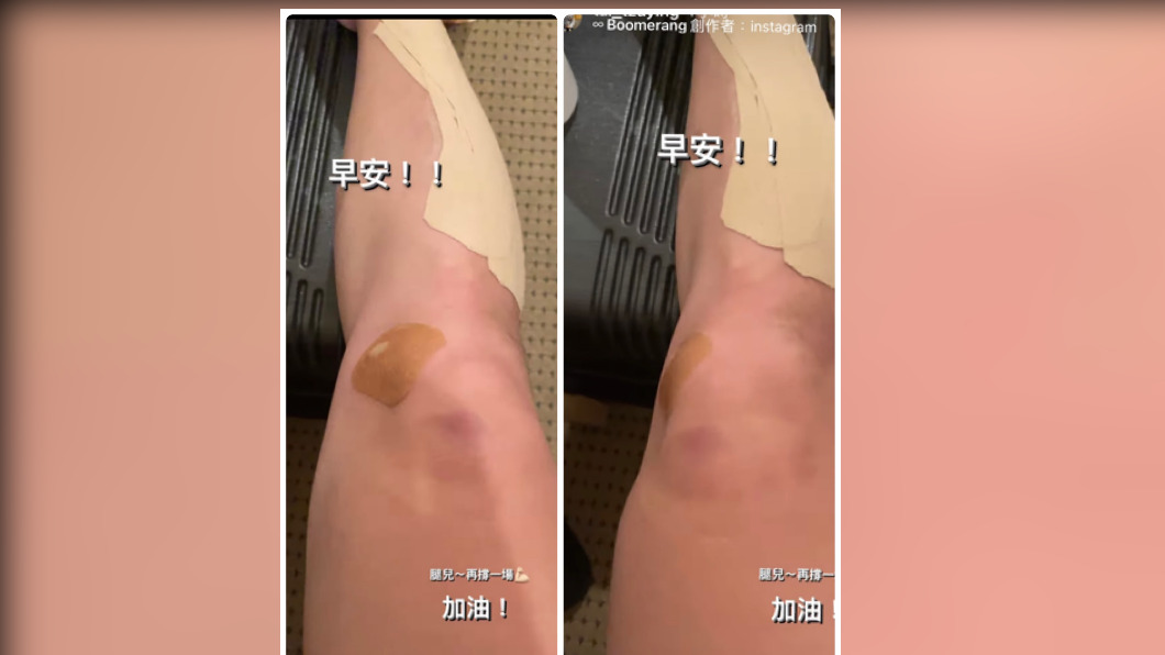 戴資穎拚金牌!雙腿滿是傷 IG發文「腿兒~再撐一點」