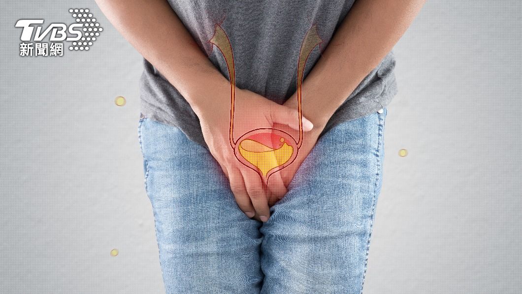 無痛性血尿恐為「尿路上皮癌」前兆。(示意圖/shutterstock達志影像)