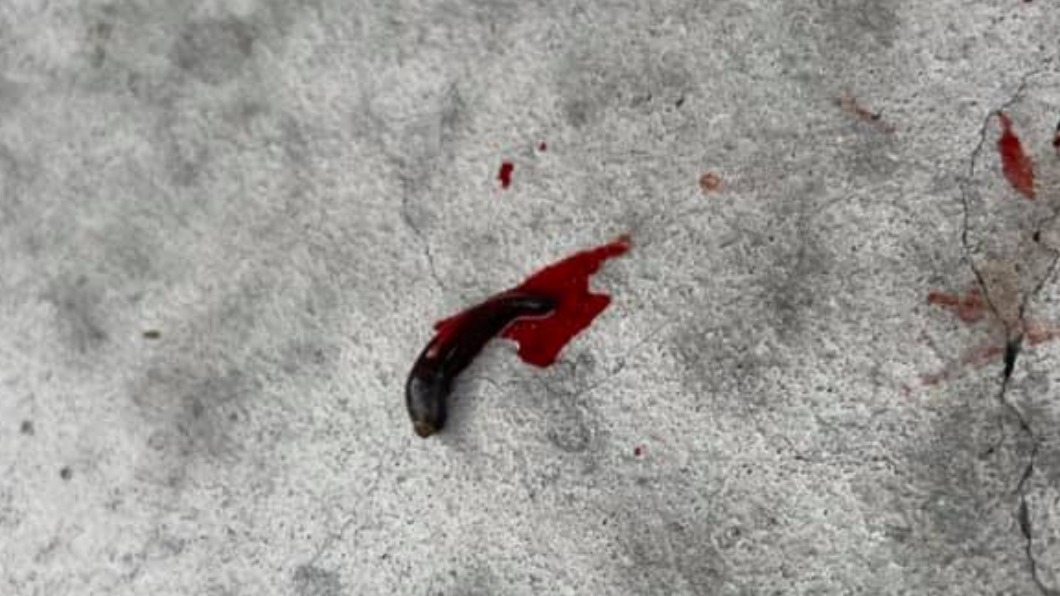 「黑蟲」緊咬大腿30分鐘!落地後狂吐血 內行曝解決法