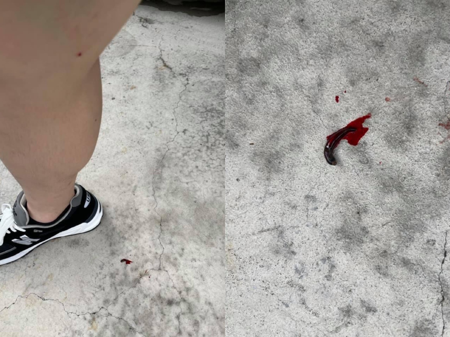 原PO也發出吸血蟲與傷口照。(圖/翻攝自爆系知識家臉書)