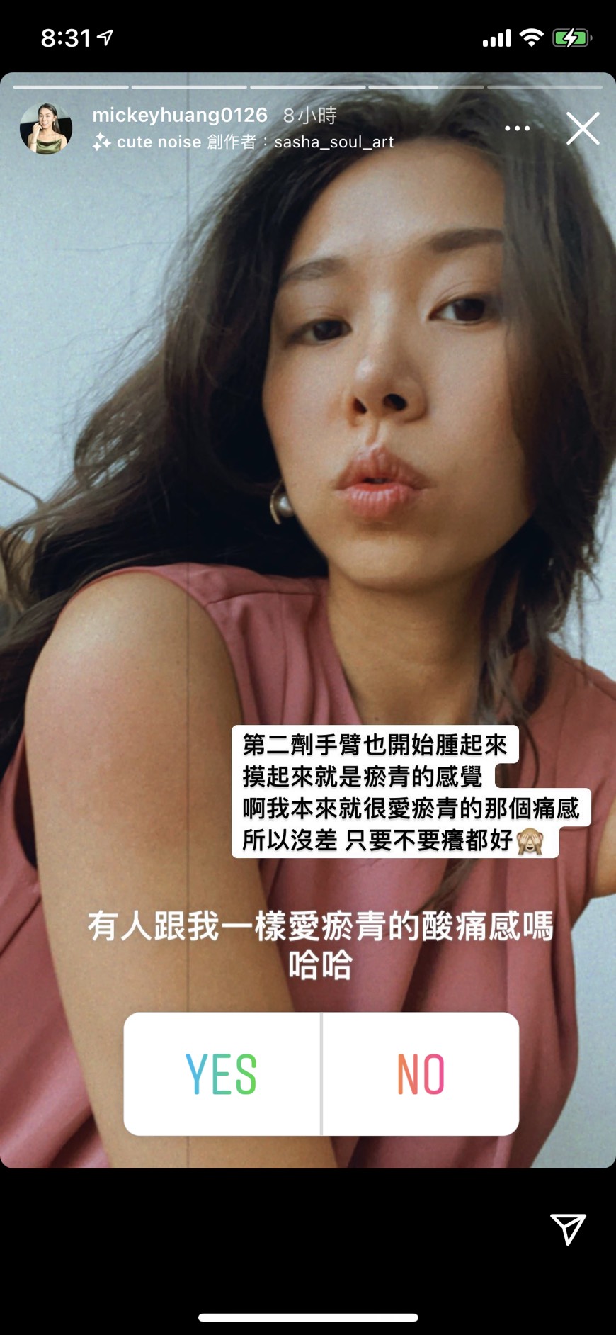 黃鈺文手臂開始腫起來。(圖/翻攝自黃鈺文Instagram)